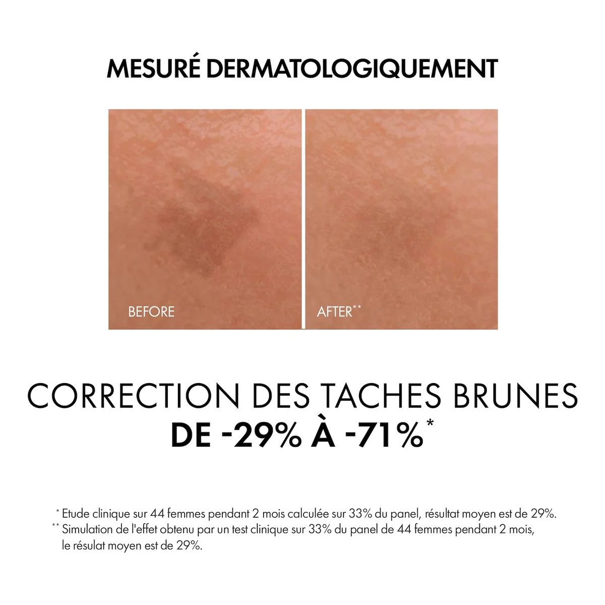 Vichy LiftActiv Sérum B3 Anti-Taches Brunes et Anti-Rides – 30ml — vue produit (12) — Maroc